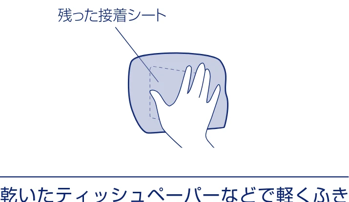 アイリスオーヤマ SBD-F2PC 取扱説明書 — ■接着シートのはがしかた — 図版 11-2 — 11ページ