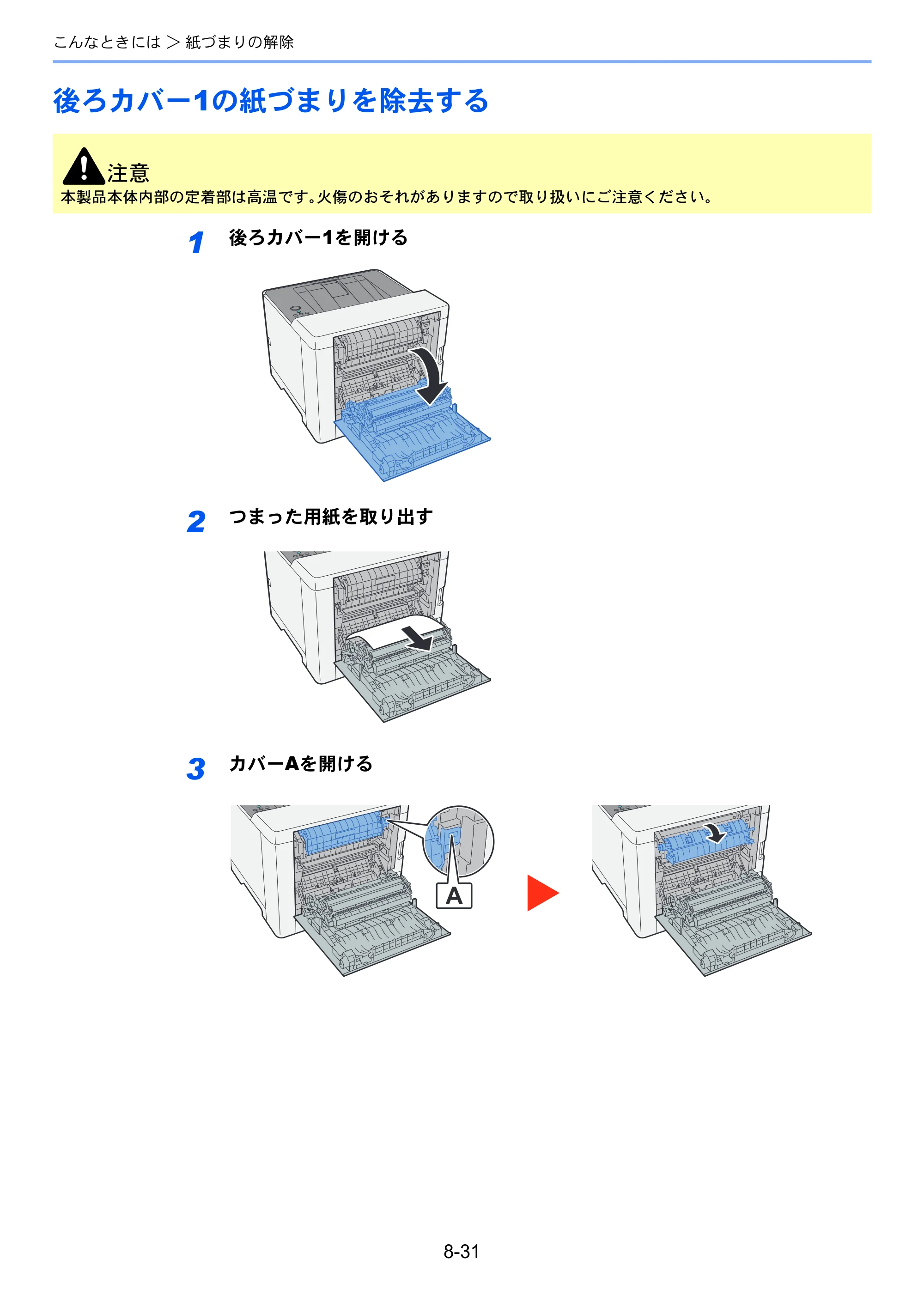 京セラ ECOSYS P5026cdw ECOSYS P5026cdw 使用説明書 — 後ろカバー1の紙づまりを除去する — 原本ページ — 194ページ