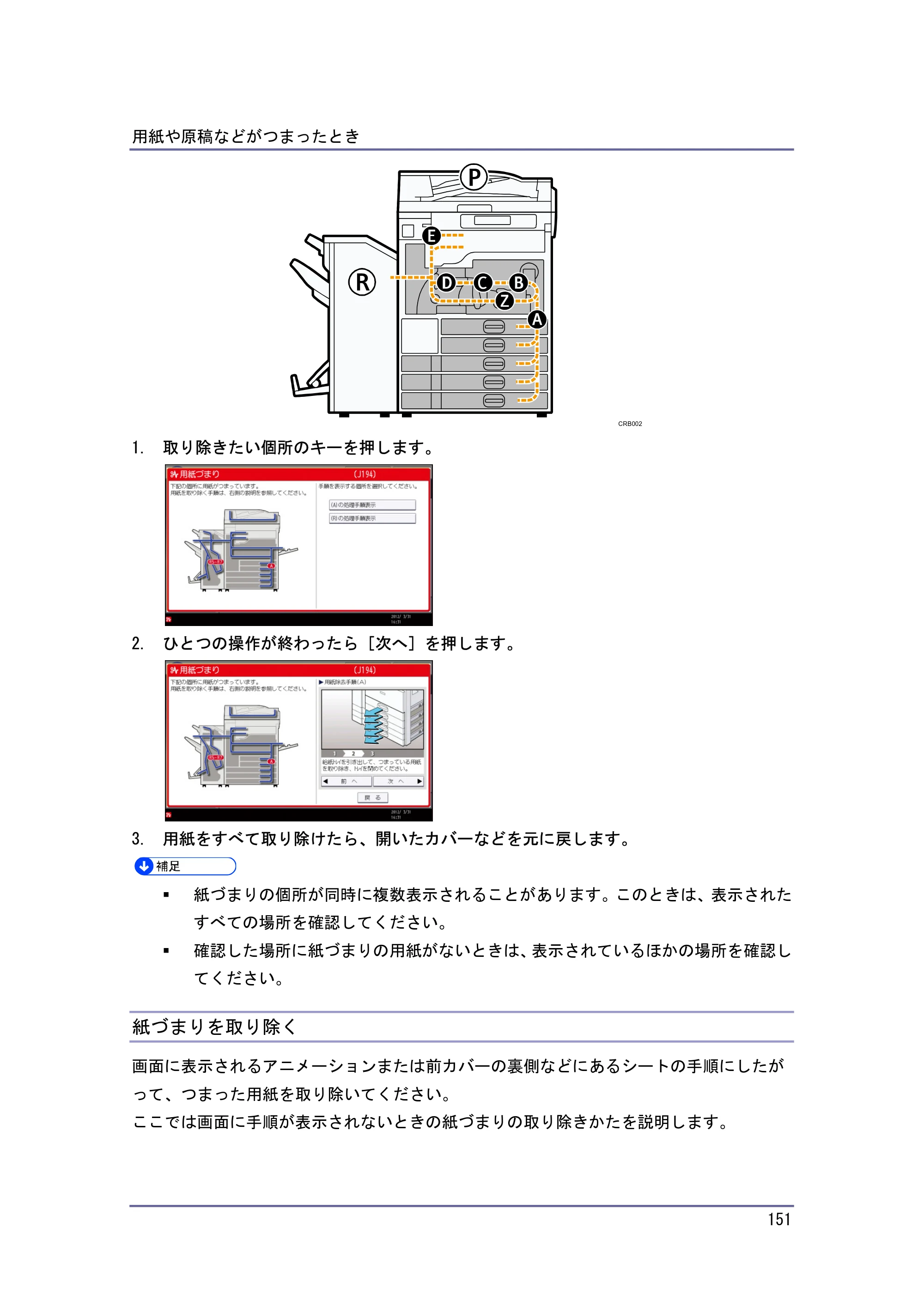 キヤノン PostScript3 こまったときには （PDF形式／4.3Mバイト） — 紙づまりを取り除く — 原本ページ — 151ページ