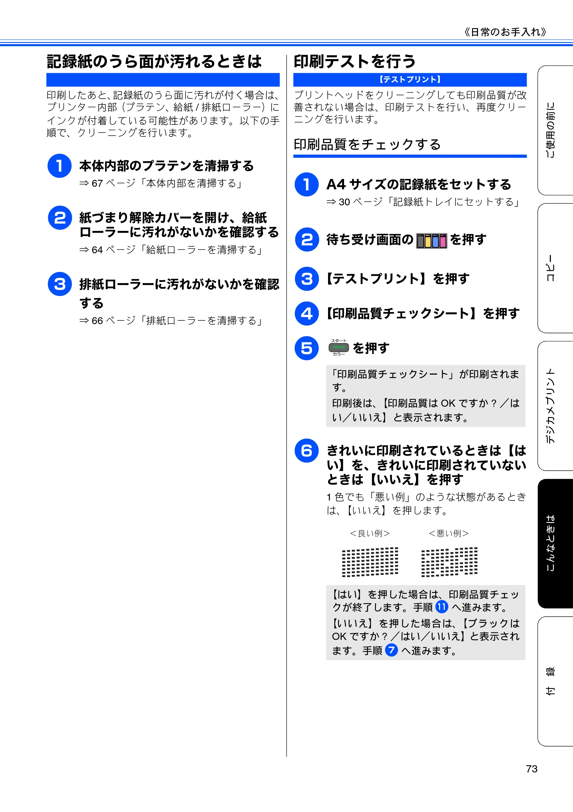 ブラザー DCP-J525N / DCP-J725N ユーザーズガイド ~基本編~ — 記録紙のうら面が汚れるときは — 原本ページ — 75ページ
