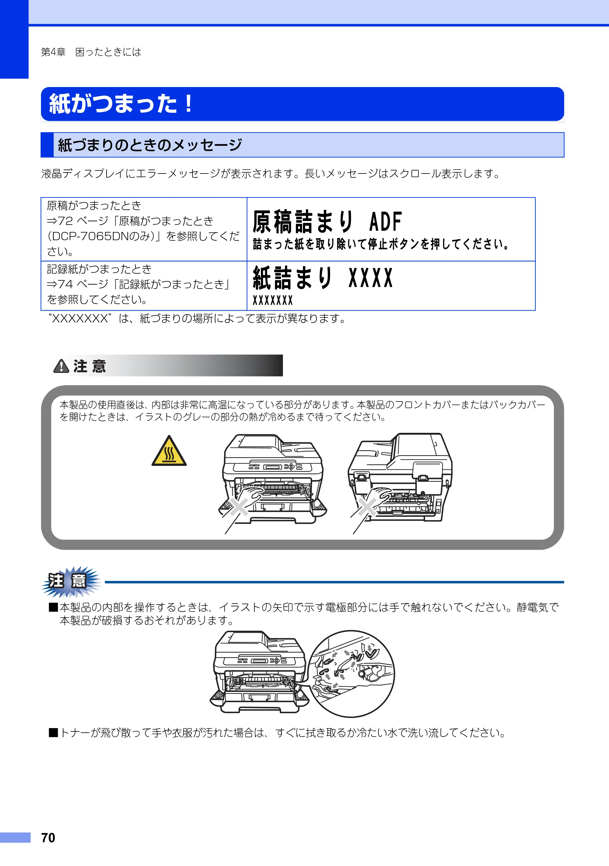ブラザー DCP-7060D / DCP-7065DN ユーザーズガイド ～基本編～ — 紙がつまった！ — 原本ページ — 70ページ