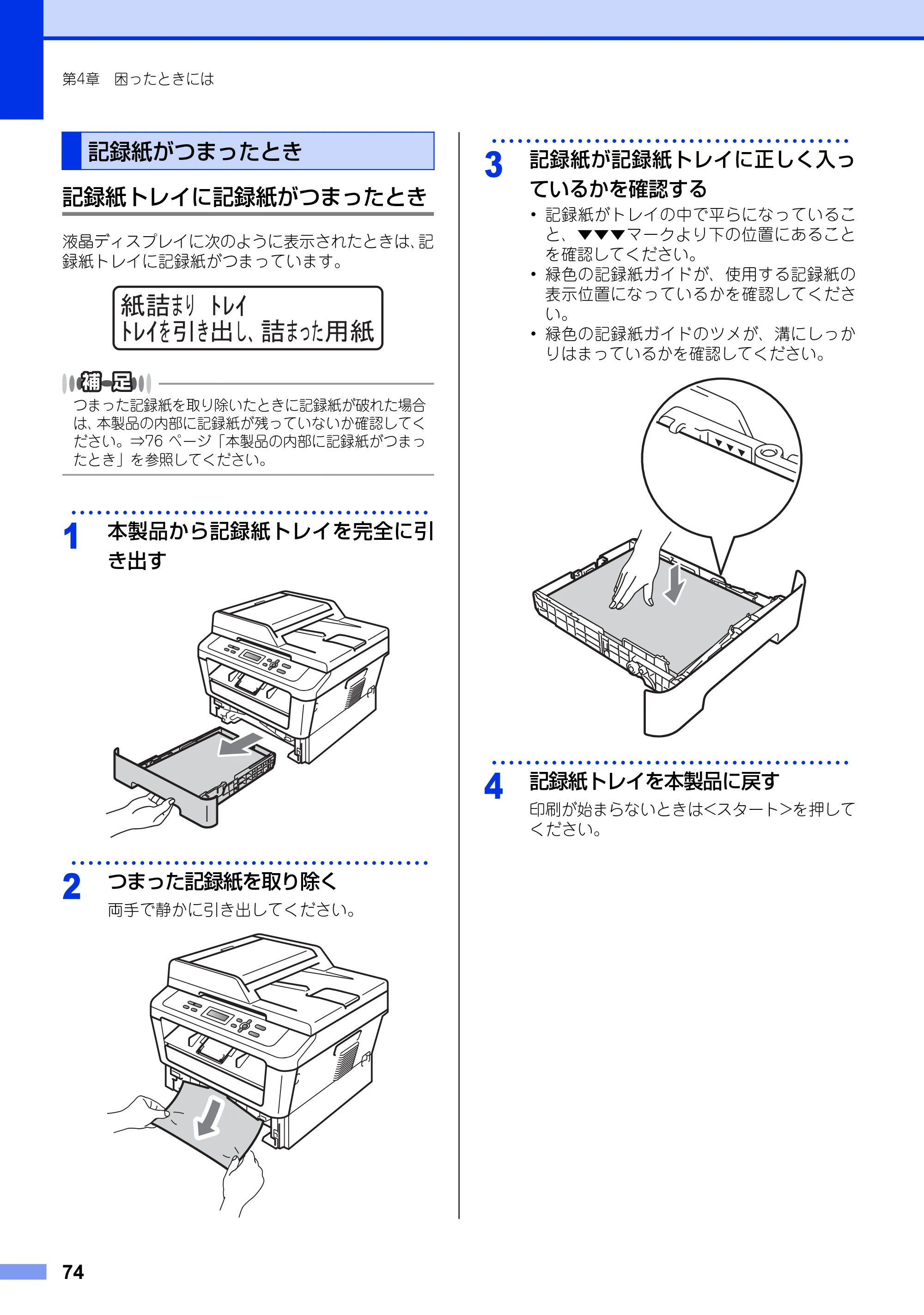 ブラザー DCP-7060D / DCP-7065DN ユーザーズガイド ～基本編～ — 記録紙がつまったとき — 原本ページ — 74ページ