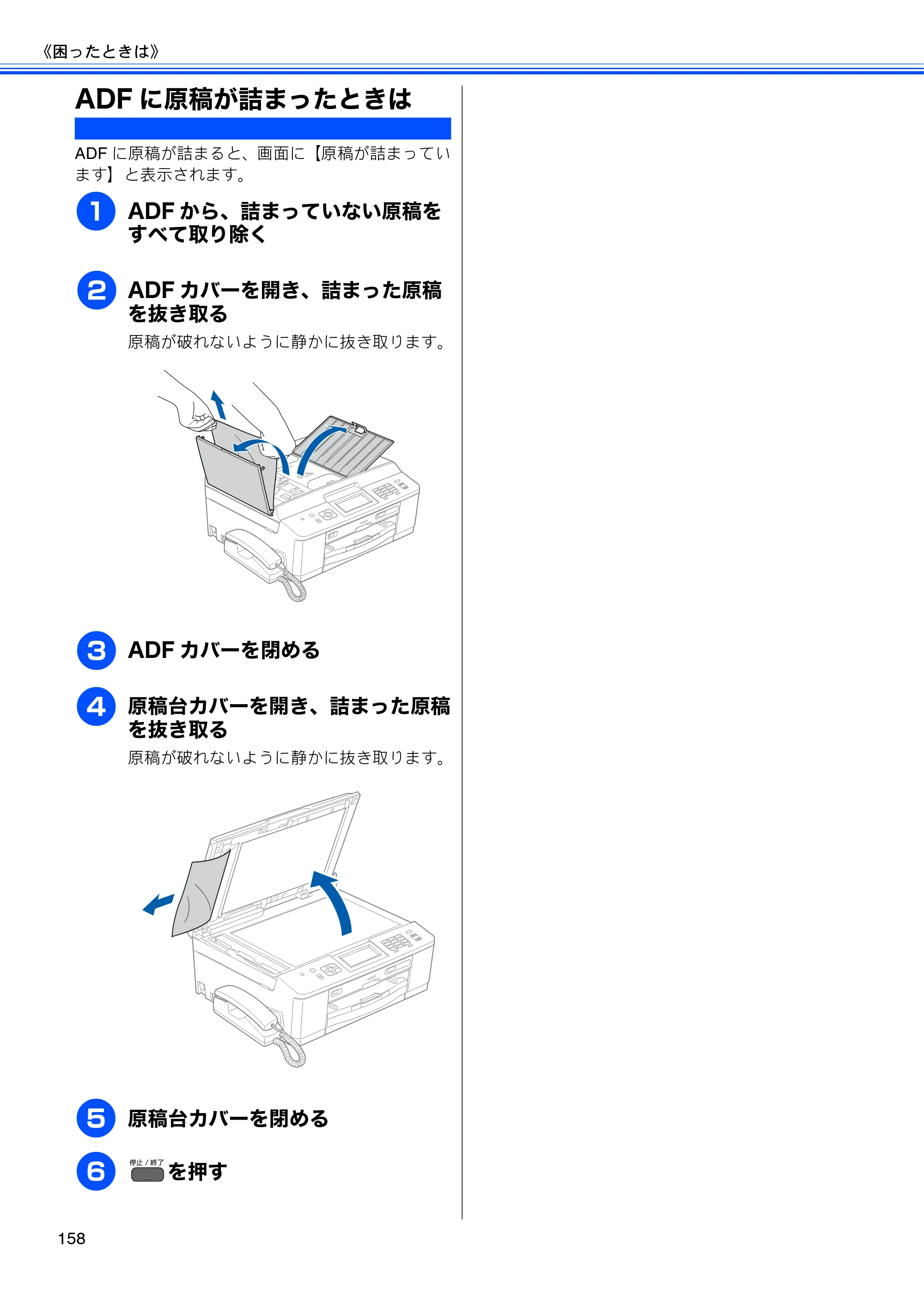 ブラザー MFC-J955DN / MFC-J955DWN ユーザーズガイド ～基本編～ — ADFに原稿が詰まったときは — 原本ページ — 160ページ