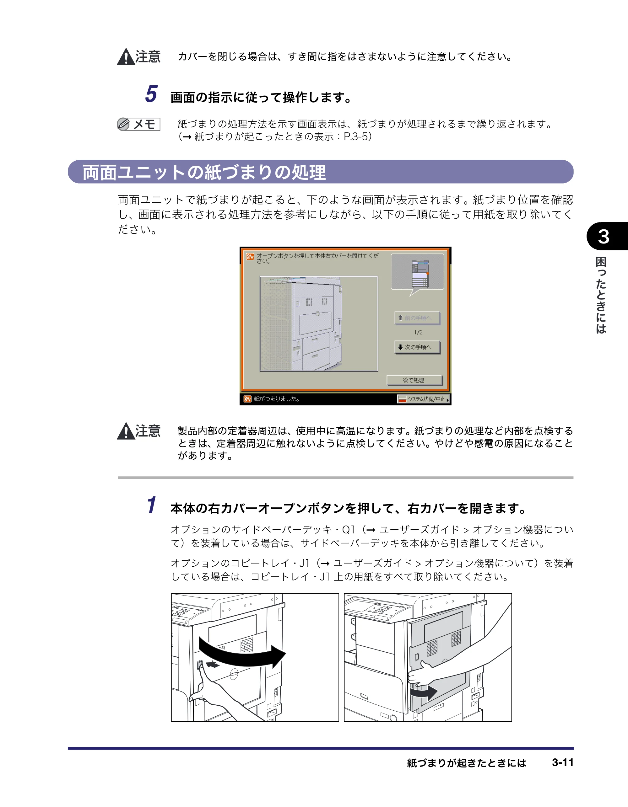 キヤノン LBP4500 操作ガイド 2011年1月20日更新 （PDF形式／19.69Mバイト） — 両面ユニットの紙づまりの処理 — 原本ページ — 109ページ