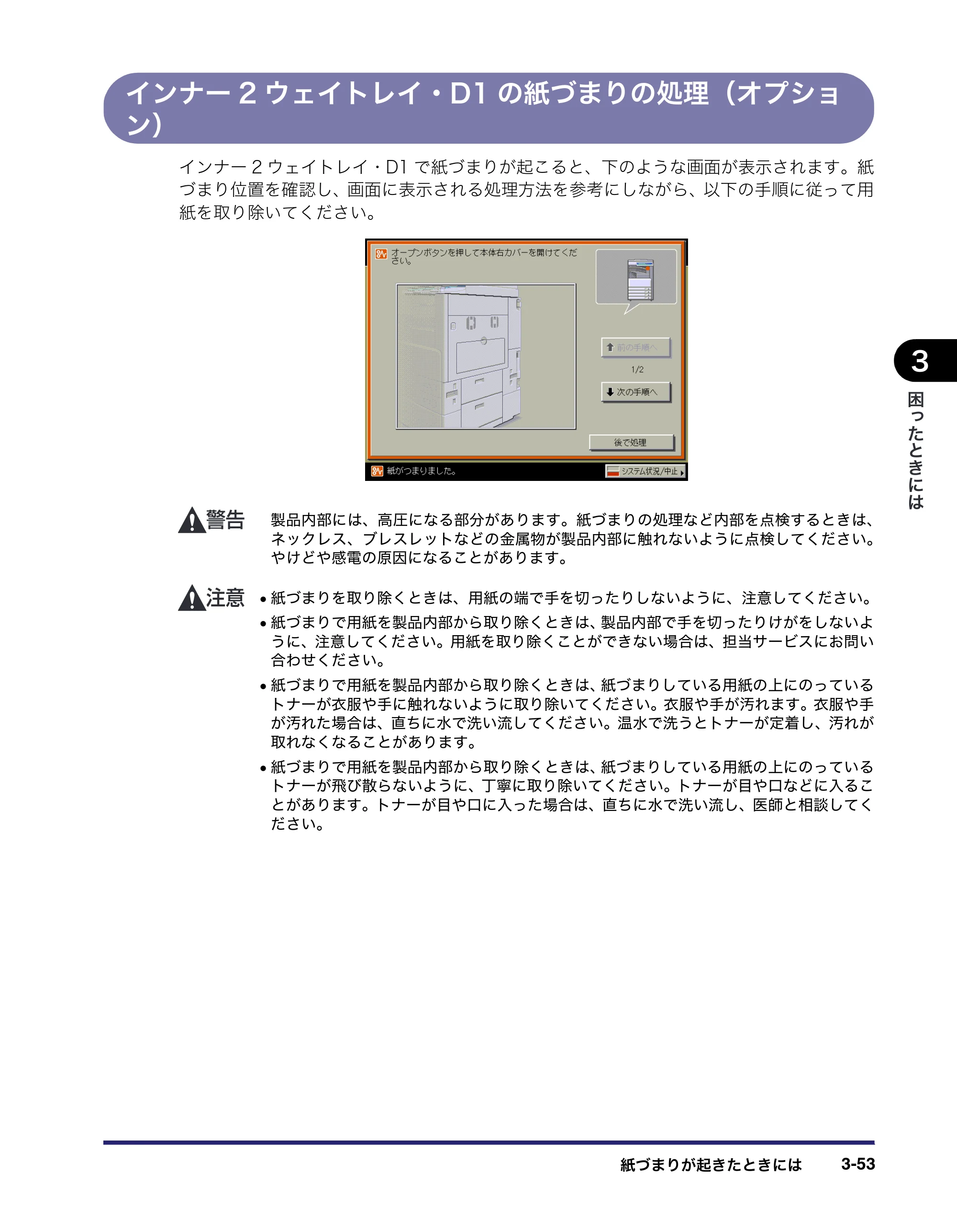 キヤノン LBP4500 操作ガイド 2011年1月20日更新 （PDF形式／19.69Mバイト） — インナー2ウェイトレイ・D1の紙づまりの処理（オプション） — 原本ページ — 151ページ