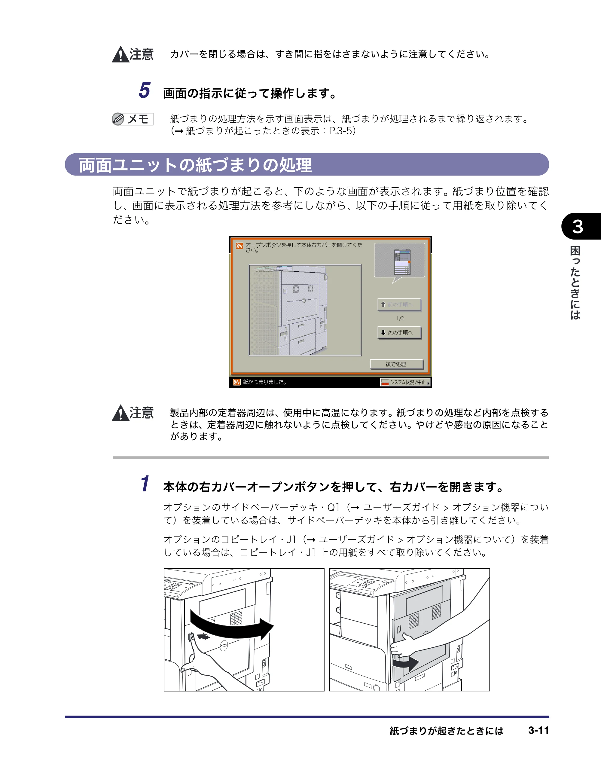 キヤノン LBP4510 操作ガイド 2012年4月17日公開（PDF：19.6MB） — 両面ユニットの紙づまりの処理 — 原本ページ — 111ページ