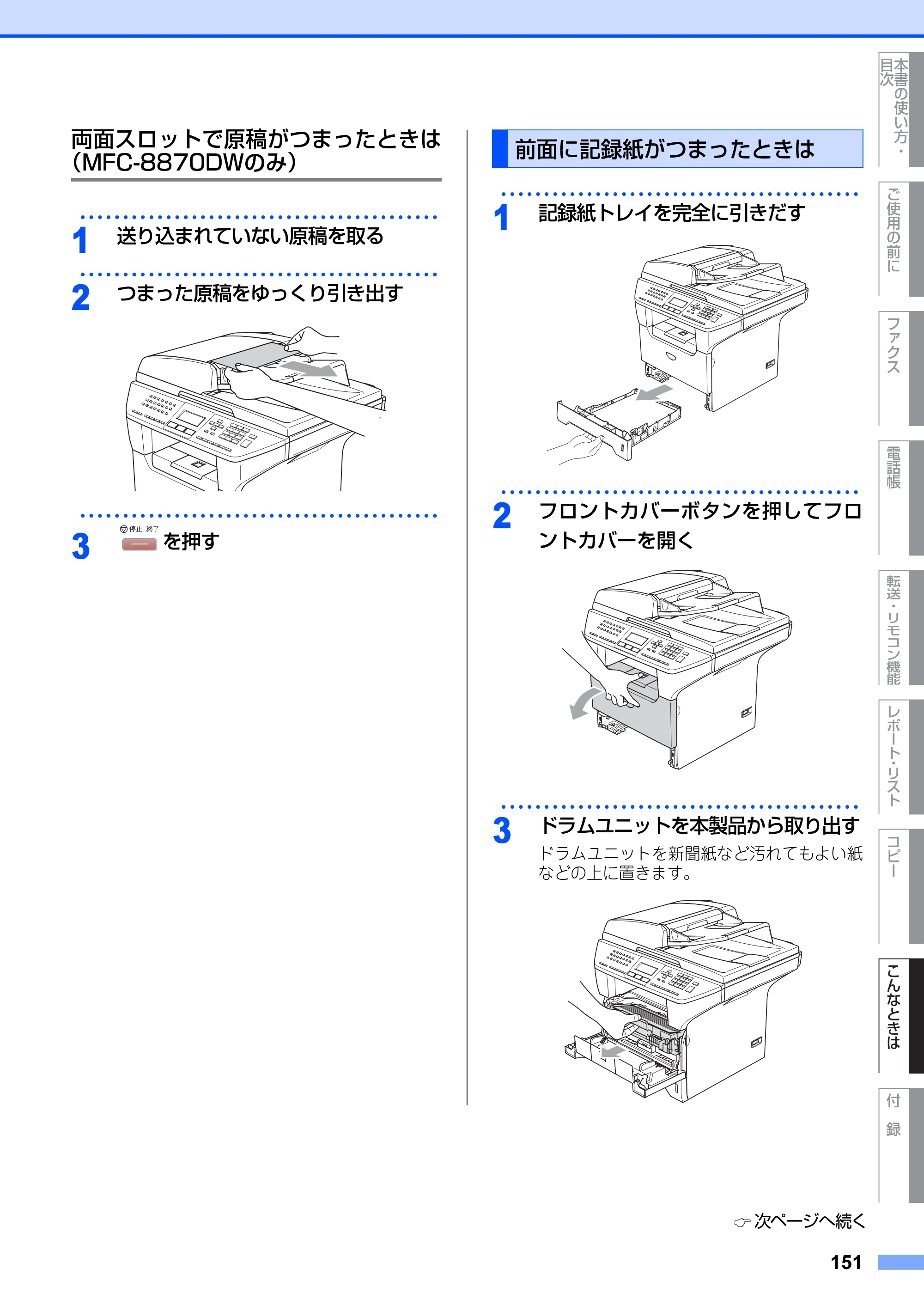 ブラザー MFC-8660DN / MFC-8870DW 取扱説明書（本体） — 前面に記録紙がつまったときは — 原本ページ — 151ページ