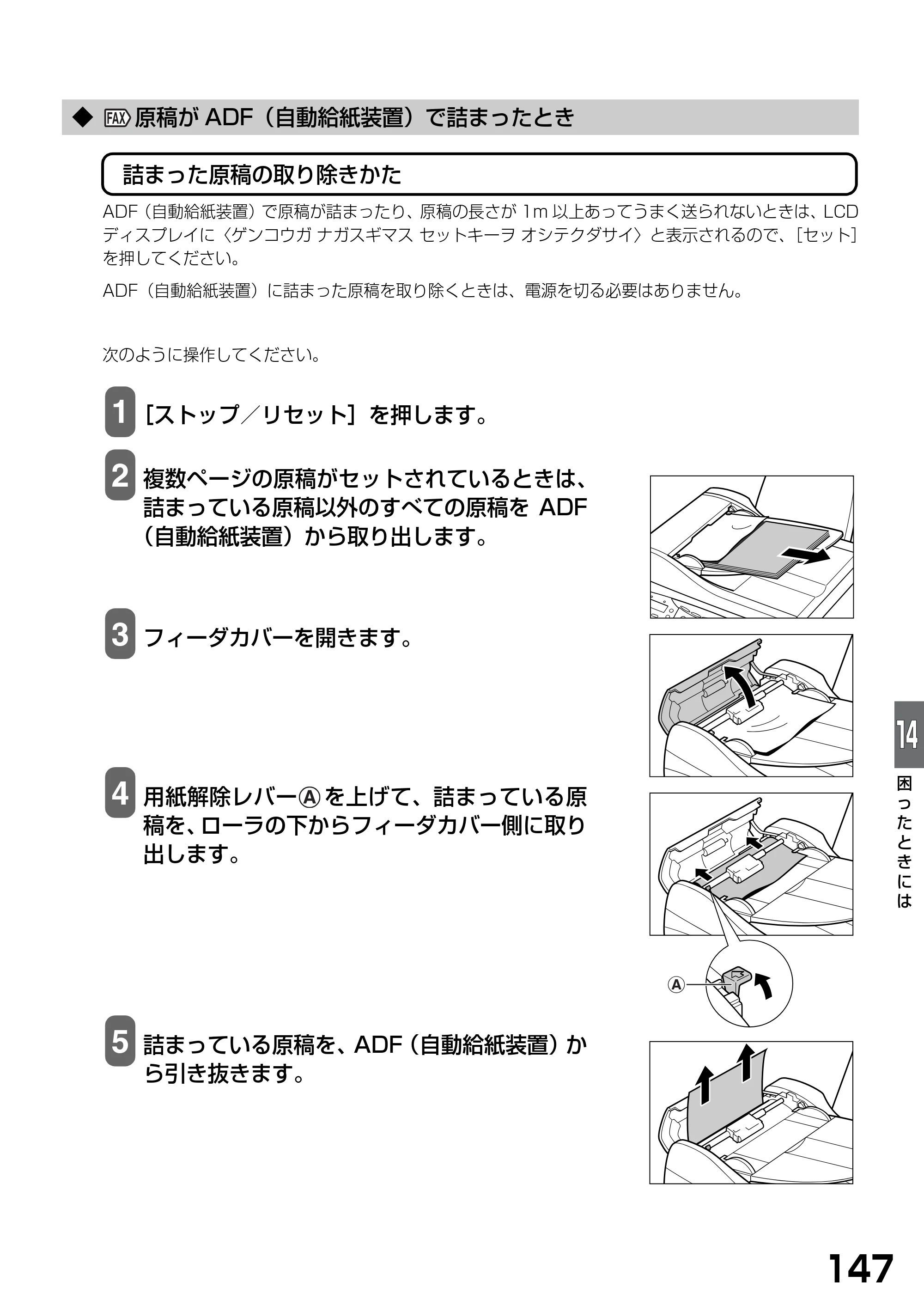 キヤノン PIXUS MP740/MP710 基本操作ガイド （PDF形式／7.84Mバイト） — ◆ 原稿がADF（自動給紙装置）で詰まったとき — 原本ページ — 149ページ