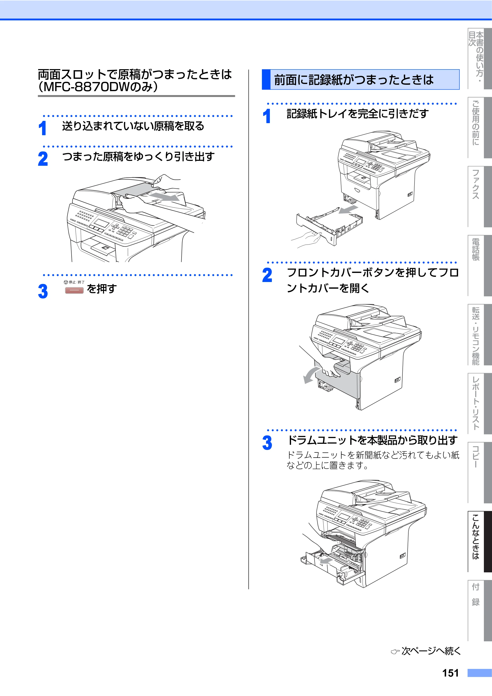 ブラザー MFC-8460N 取扱説明書（本体） — 前面に記録紙がつまったときは — 原本ページ — 151ページ