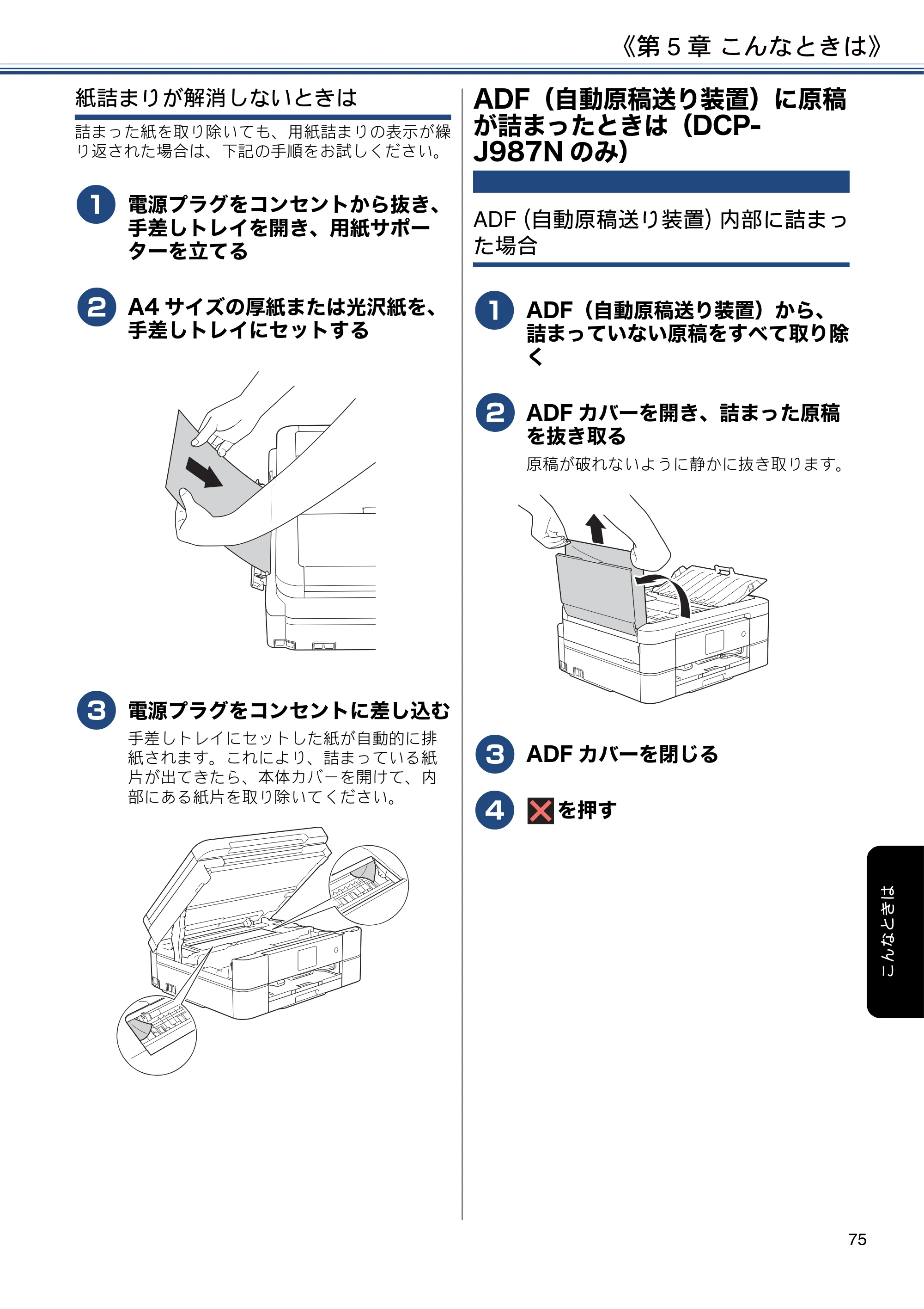 ブラザー DCP-J587N / DCP-J987N ユーザーズガイド ～応用編～ — ADF（自動原稿送り装置）に原稿が詰まったときは（DCP-J987Nのみ） — 原本ページ — 75ページ