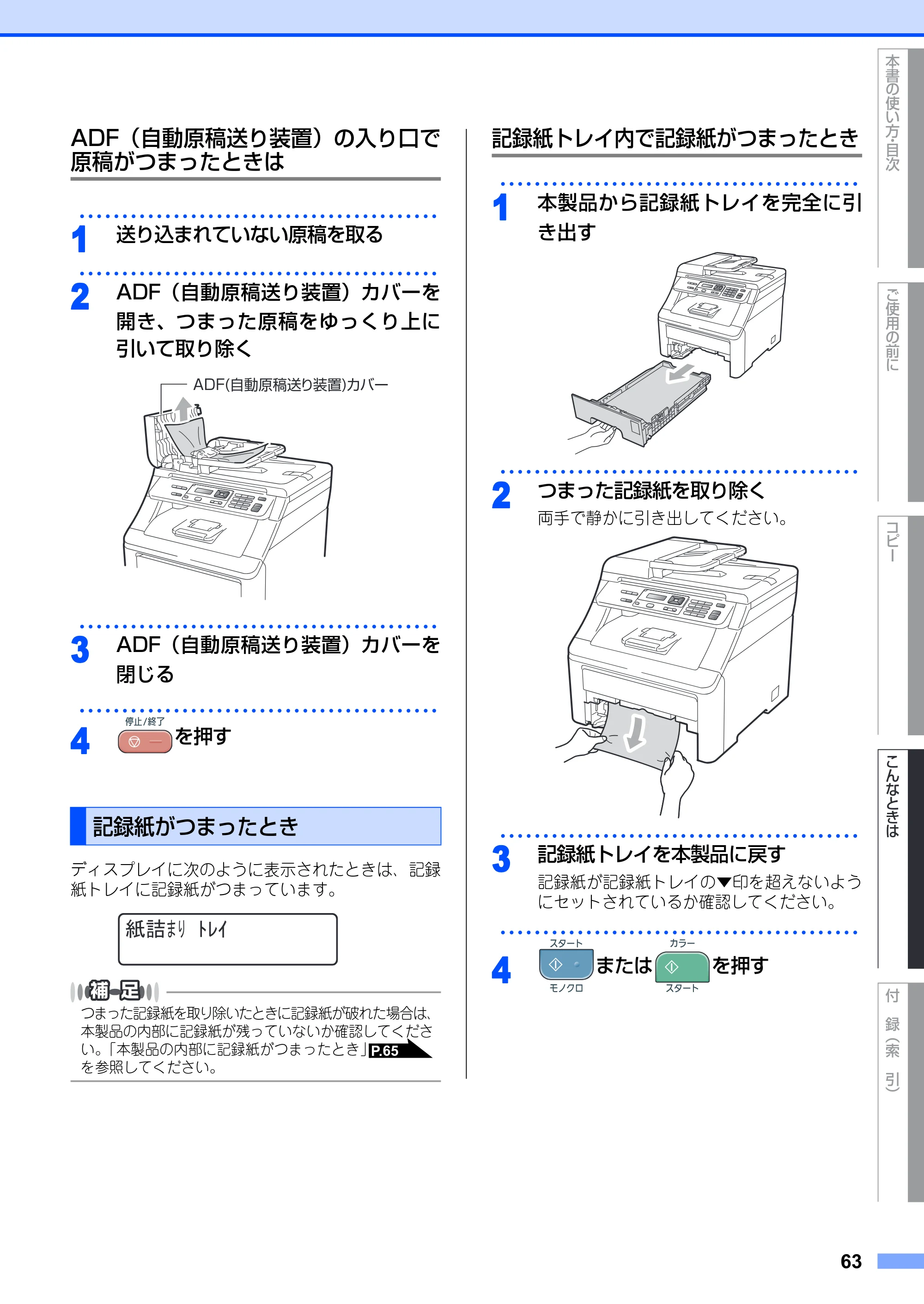ブラザー DCP-9010CN ユーザーズガイド ～基本編～ — 原本ページ — 63ページ